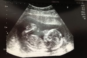 Perkembangan Janin Minggu ke Minggu