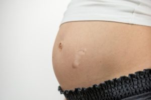 Tips Penting Persiapan Kehamilan agar Sehat dan Lancar